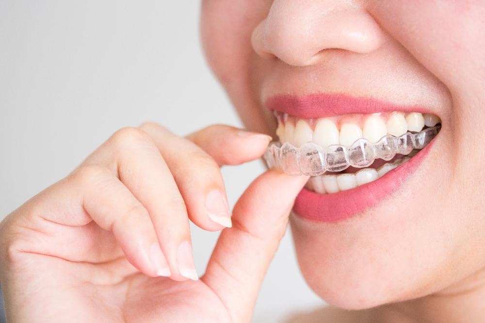 woman holding clear aligners